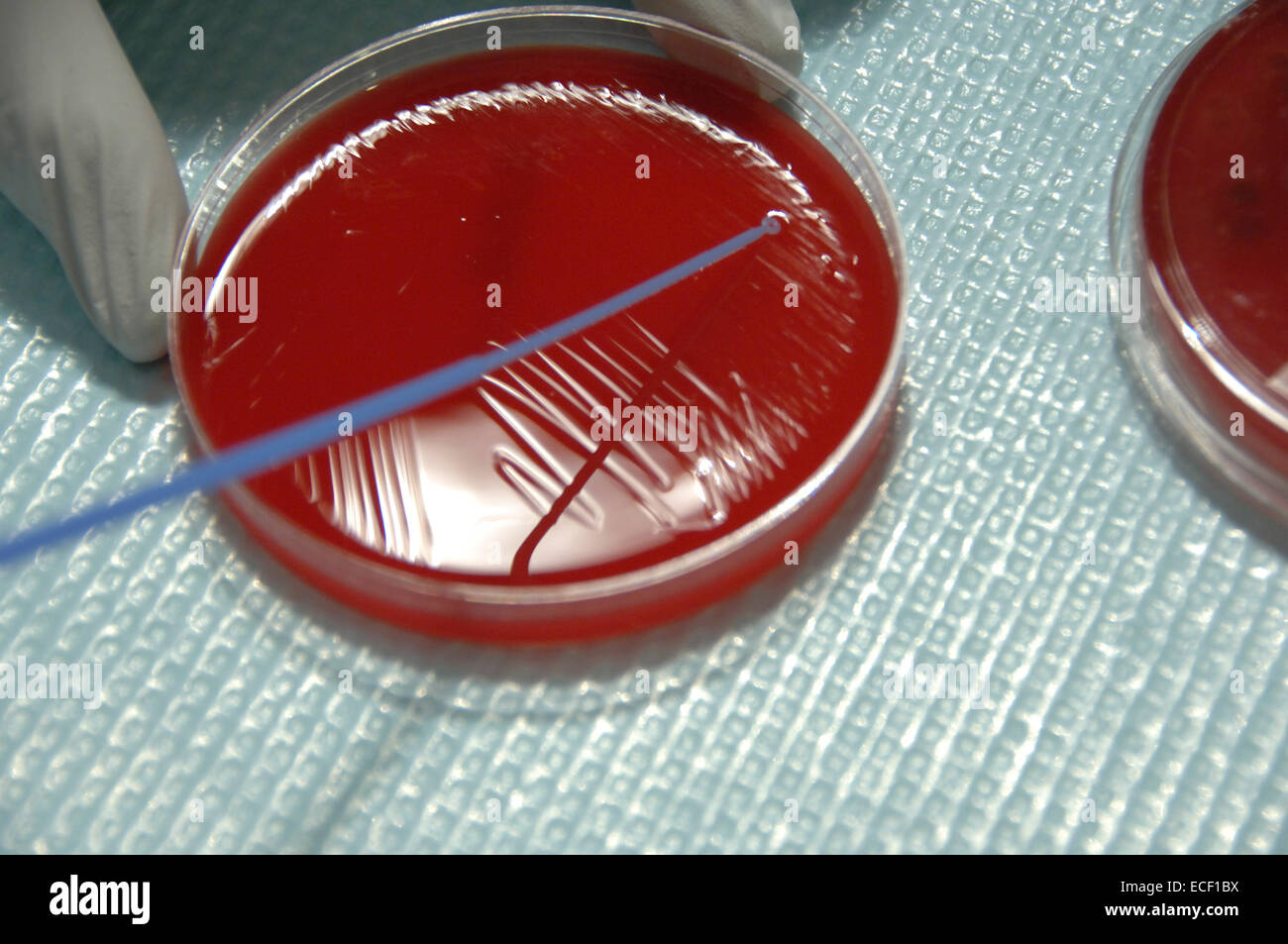 Staphylococcus bacteria from human skin grown on agar in the laboratory. Stock Photo
