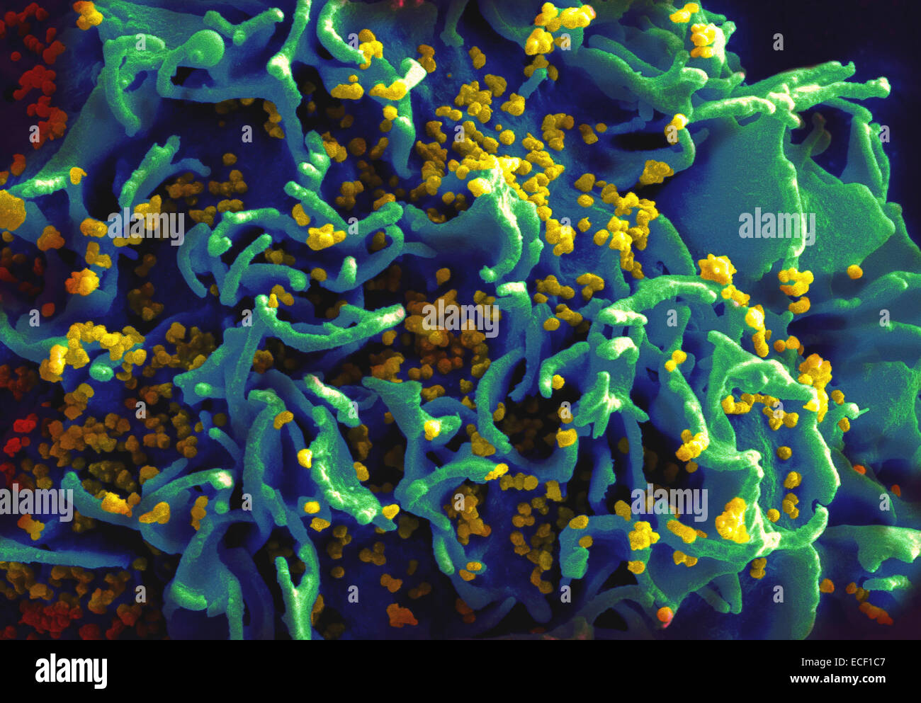 Scanning electron micrograph of HIV particles infecting a human T cell. Stock Photo