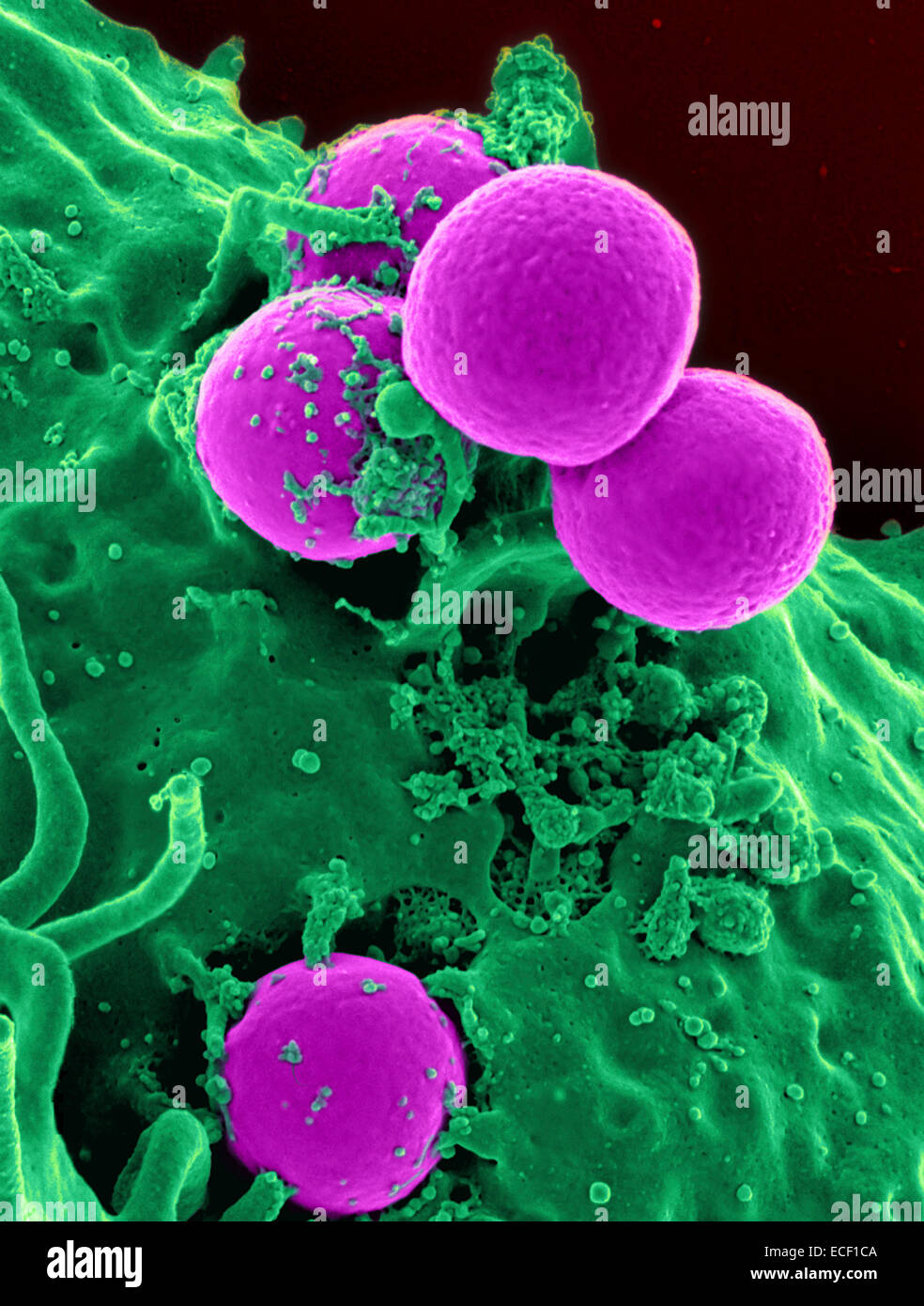 Scanning electron micrograph of a human neutrophil ingesting MRSA. Stock Photo