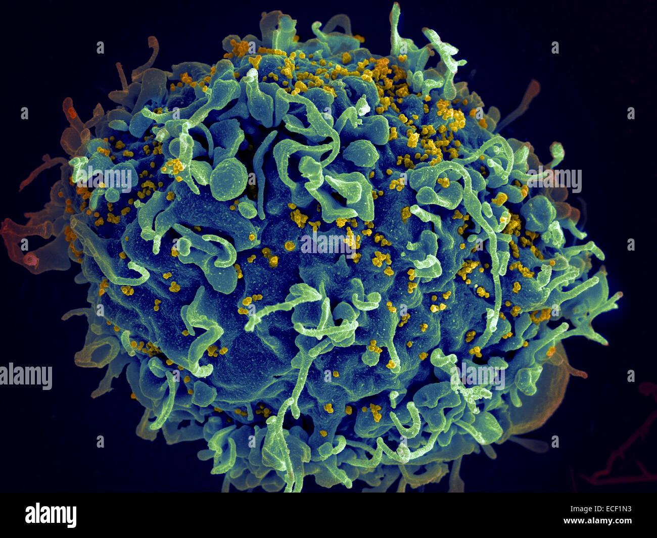 Scanning electron micrograph of HIV particles infecting a human H9 T cell. Stock Photo