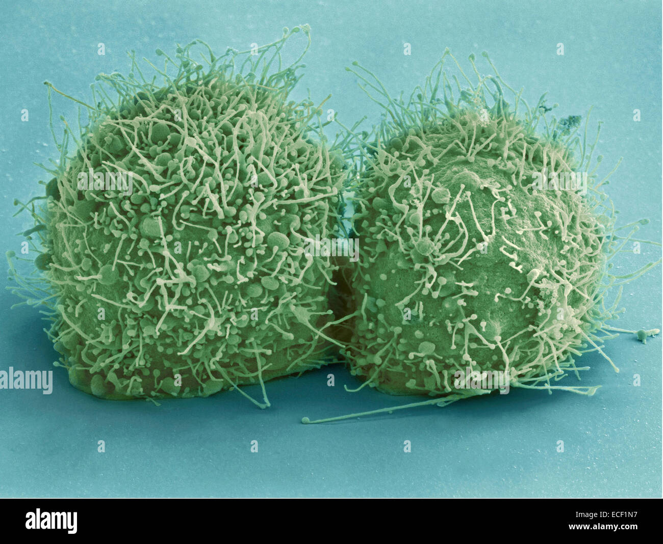 Scanning electron micrograph of just-divided HeLa cells. Zeiss Merlin HR-SEM. Stock Photo