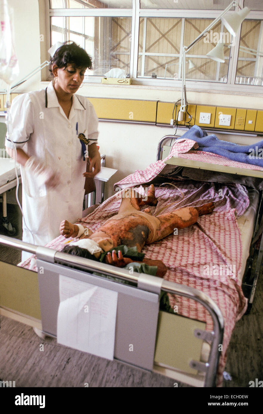 Nurse takes care of badly burned boy in the burn unit of Saddam Hussein