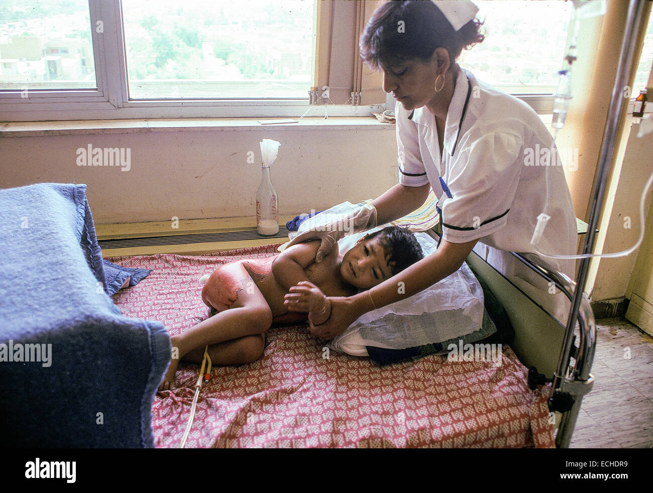 Nurse tends to badly burned boy in the burn unit of Saddam Hussein Children's Hospital in Baghdad, Iraq.  No pain medications are available because of UN Sanctions after the Gulf War. Stock Photo