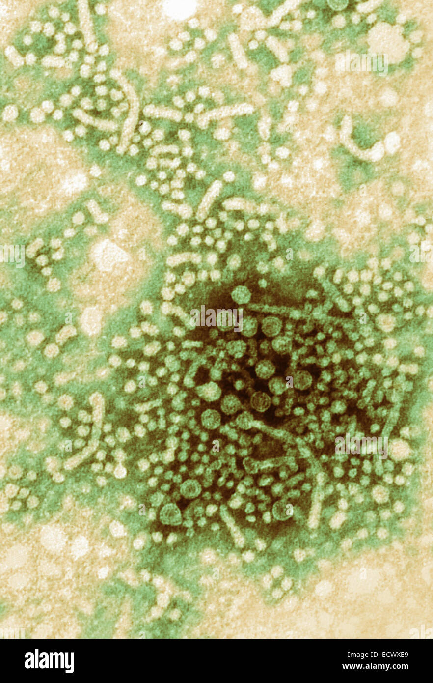 Transmission electron micrograph of hepatitis B virus. Stock Photo