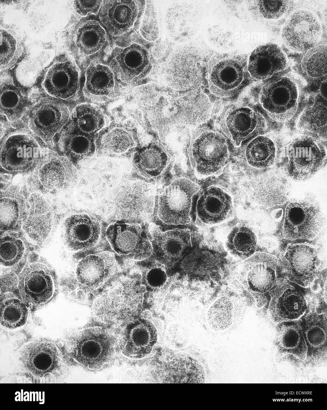 Transmission electron micrograph of herpes simplex virions. Stock Photo
