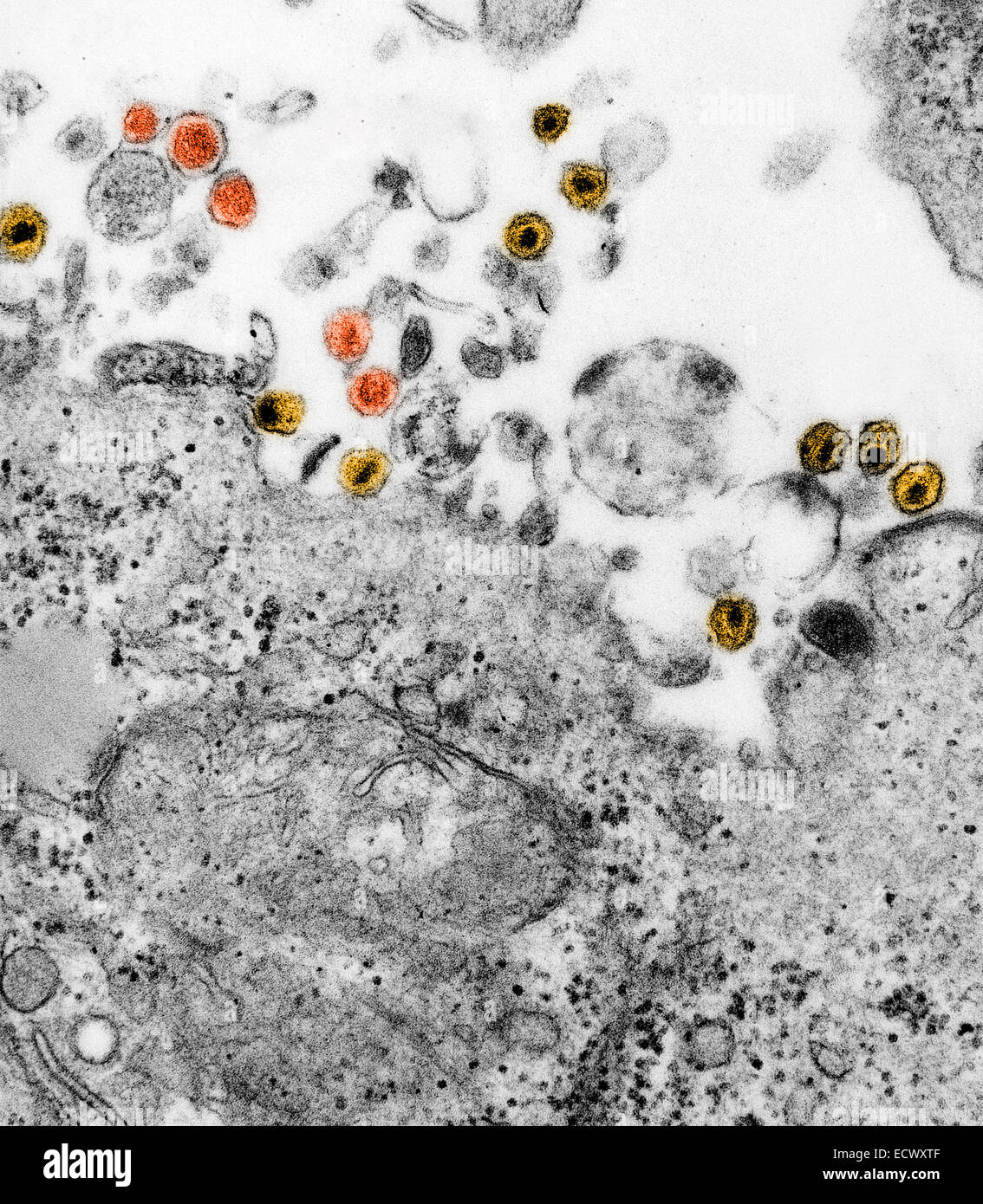 Human T-Cell Leukemia Virus and HIV. Stock Photo