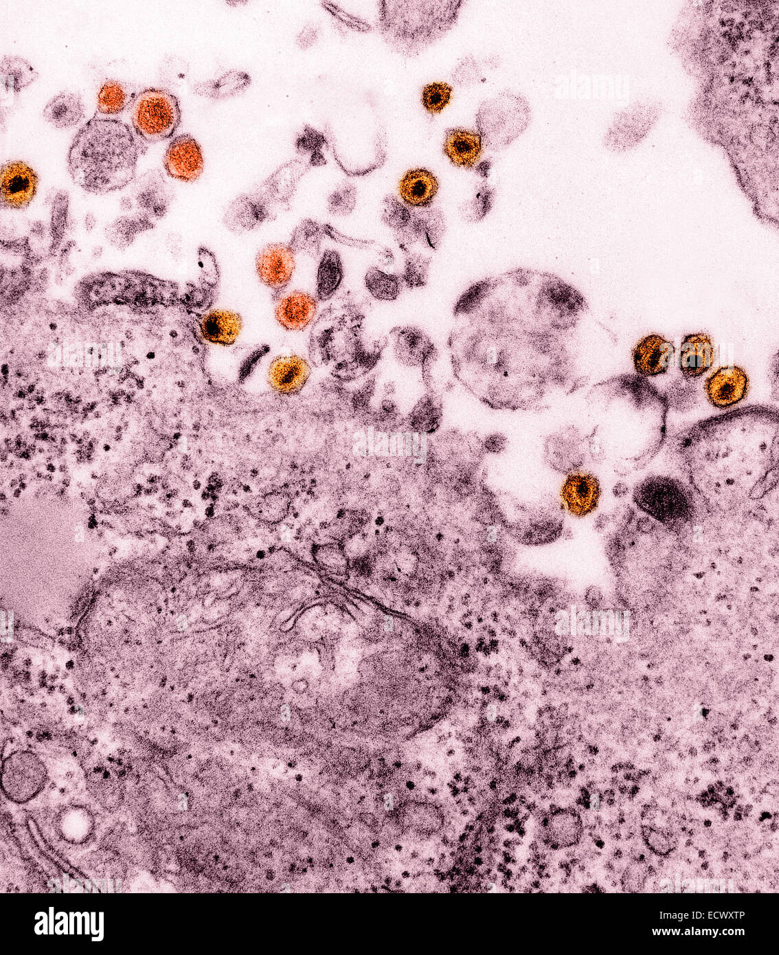 Human T-Cell Leukemia Virus and HIV. Stock Photo