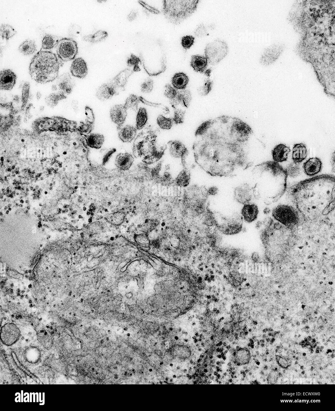 Human t cell leukemia virus hi-res stock photography and images - Alamy