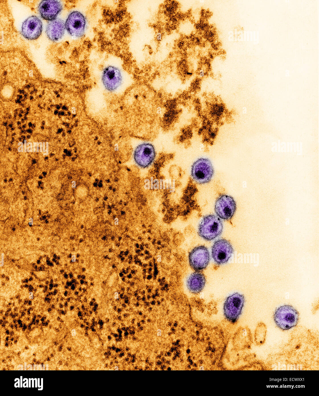 Electron micrograph of Human Immunodeficiency Virus, HIV. Stock Photo