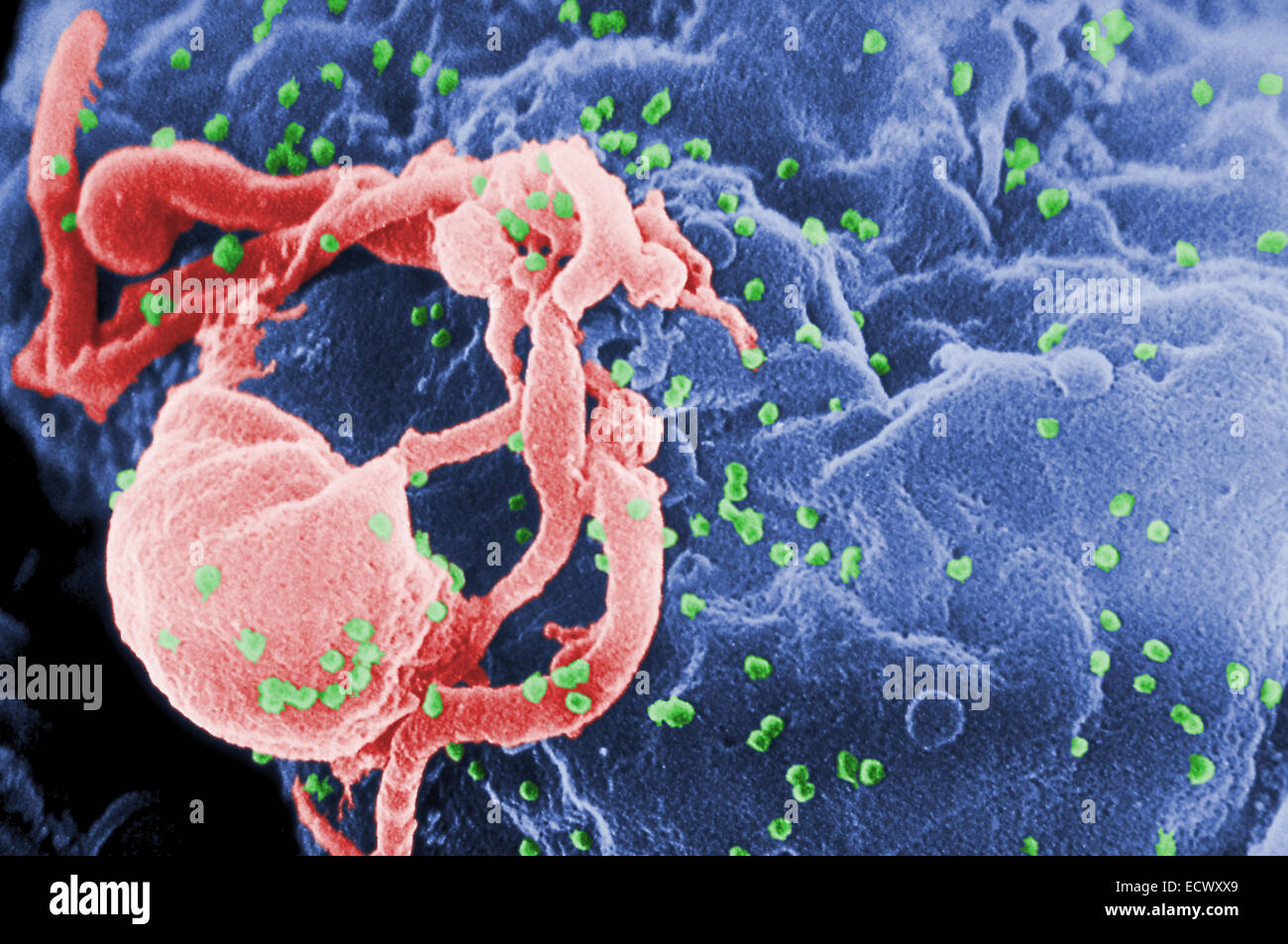 Electron micrograph of Human Immunodeficiency Virus, HIV. Stock Photo