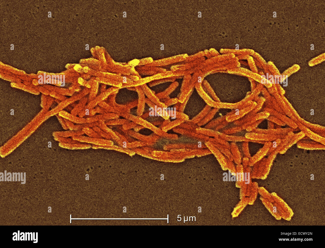 Scanning electron micrograph of Legionella bacteria. Stock Photo
