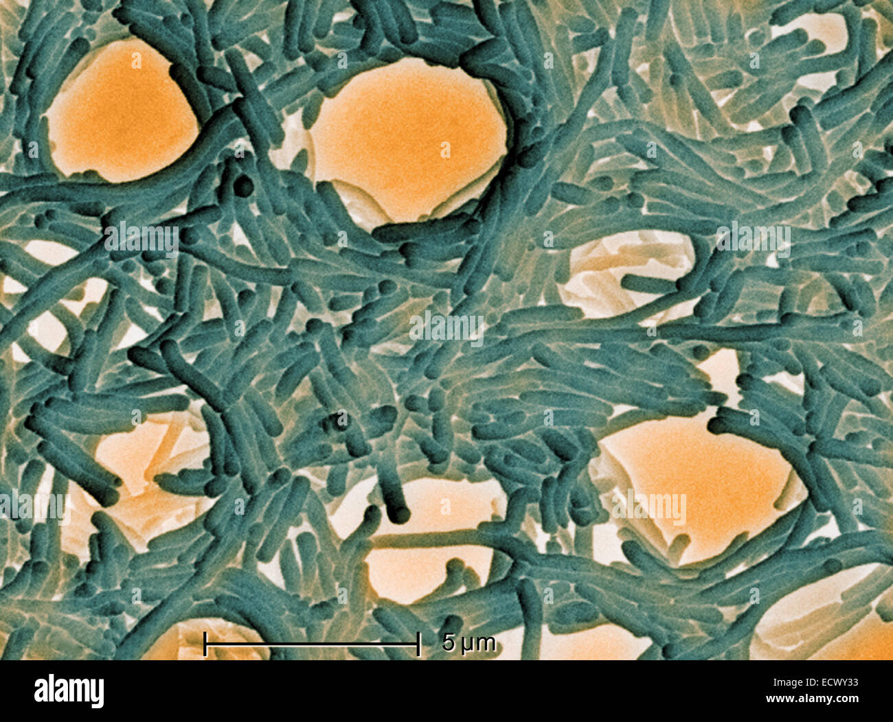 Scanning electron micrograph of Legionella bacteria. Stock Photo