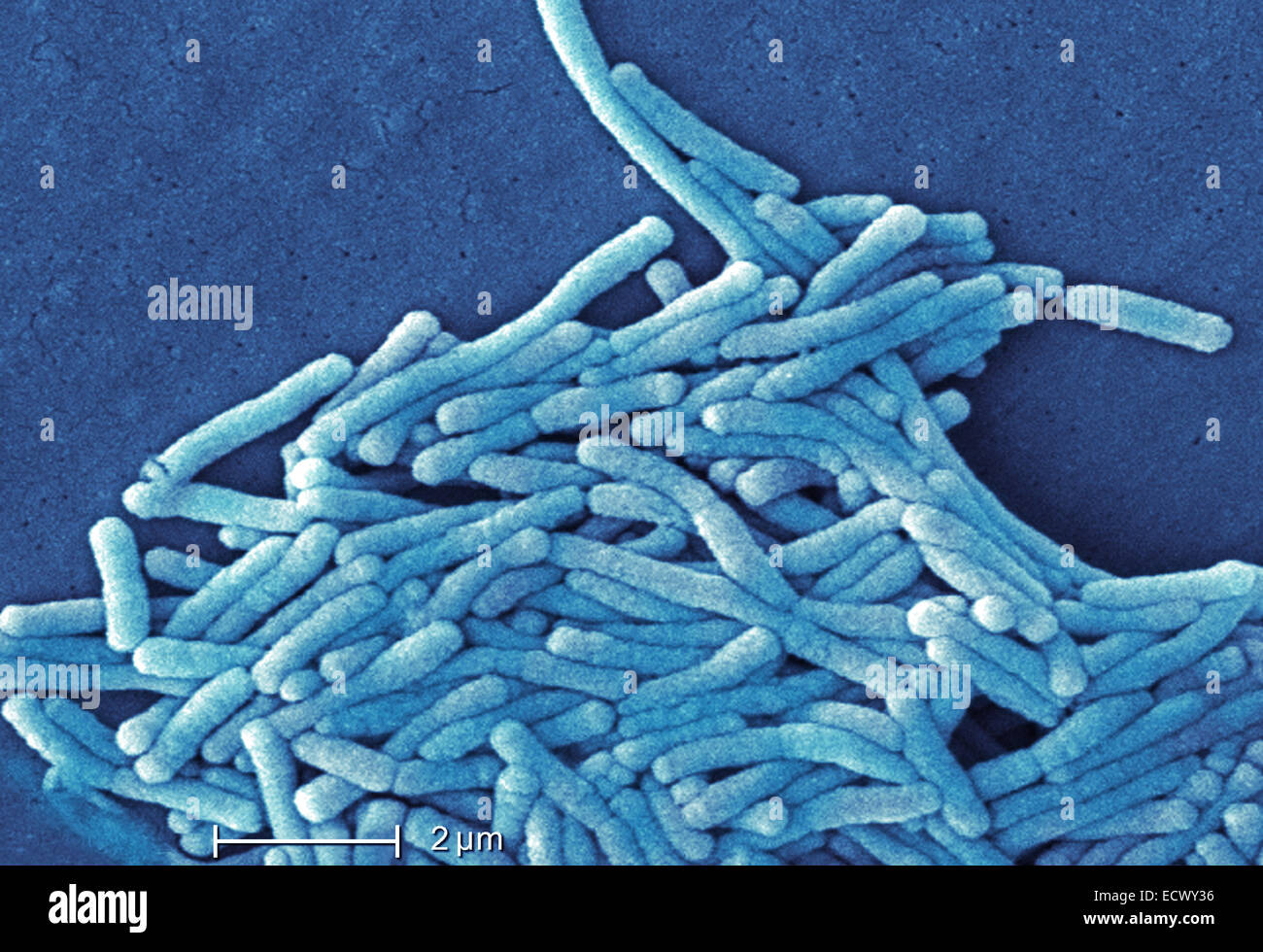 Scanning electron micrograph of Legionella bacteria. Stock Photo