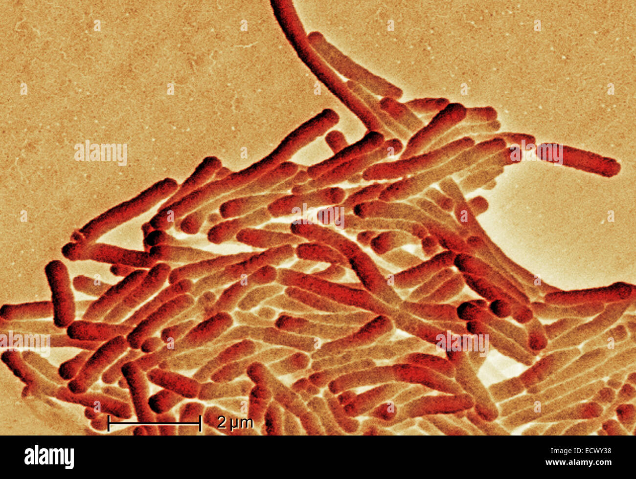 Scanning electron micrograph of Legionella bacteria. Stock Photo