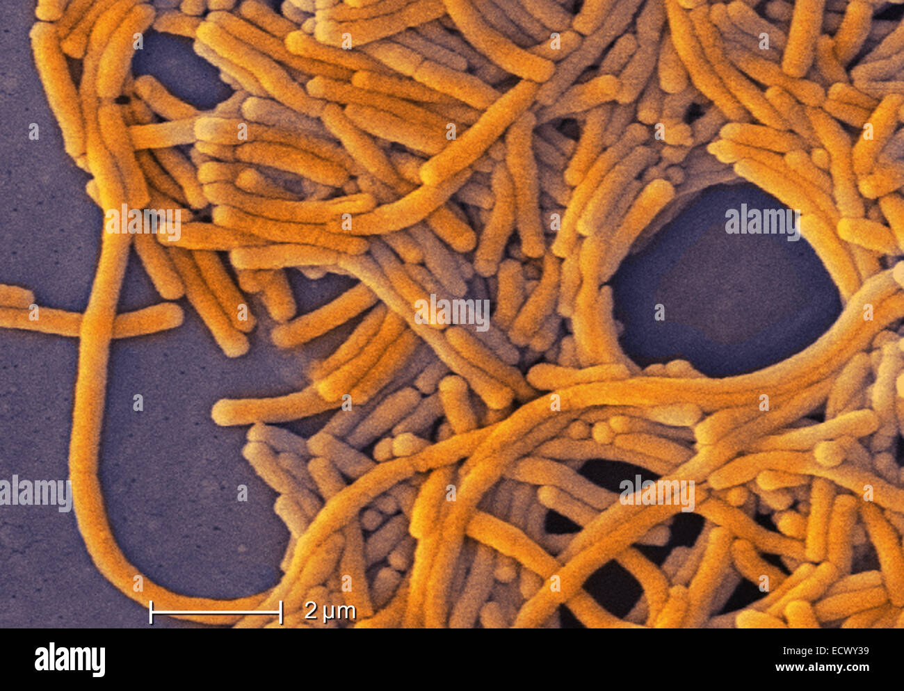 Scanning electron micrograph of Legionella bacteria. Stock Photo