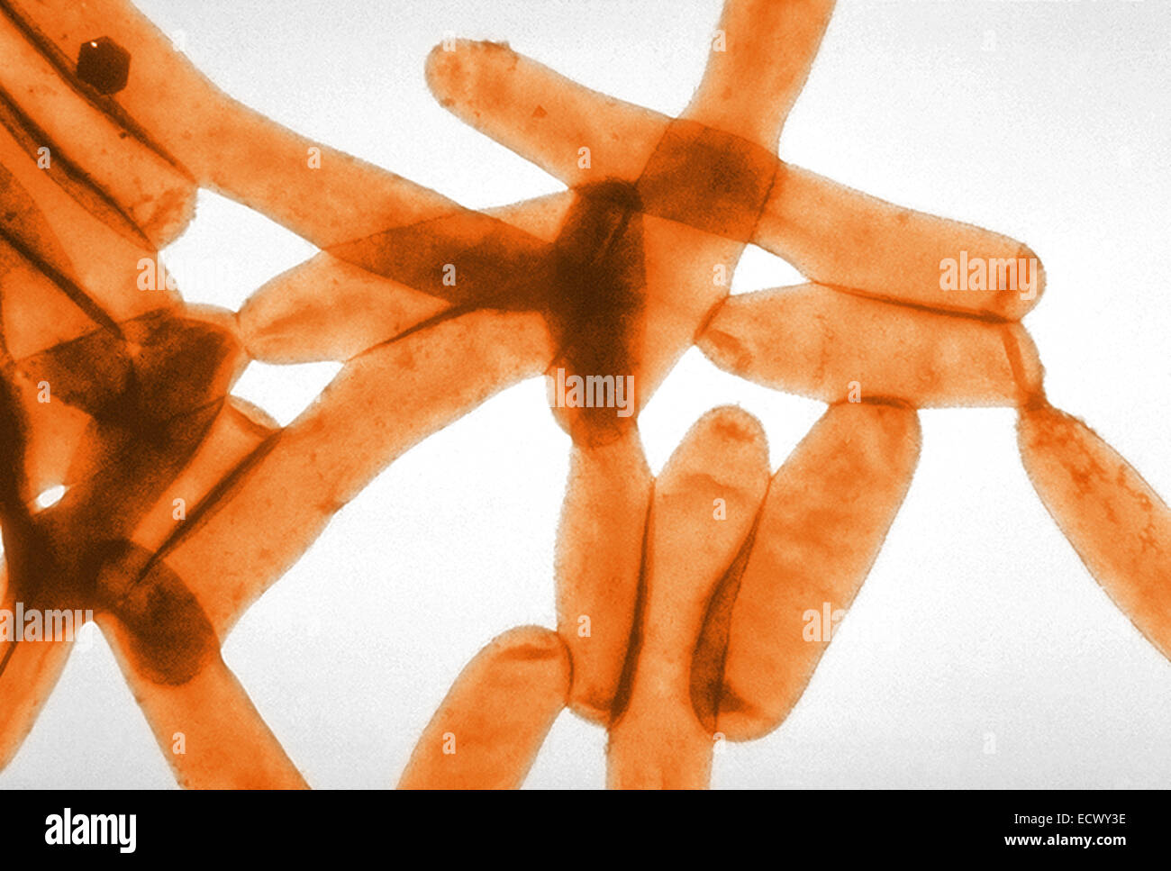 Scanning electron micrograph of Legionella bacteria. Stock Photo