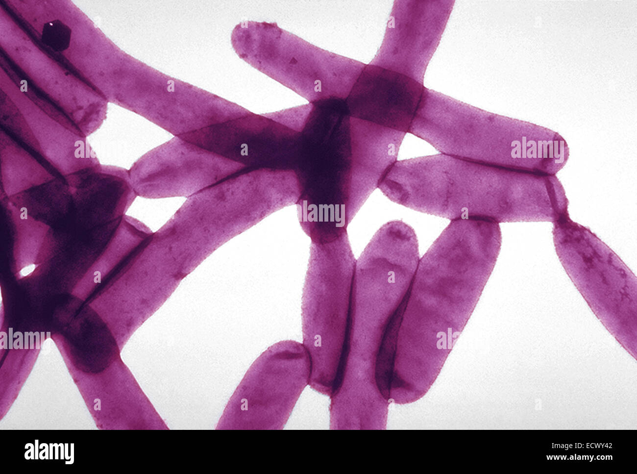 Scanning electron micrograph of Legionella bacteria. Stock Photo