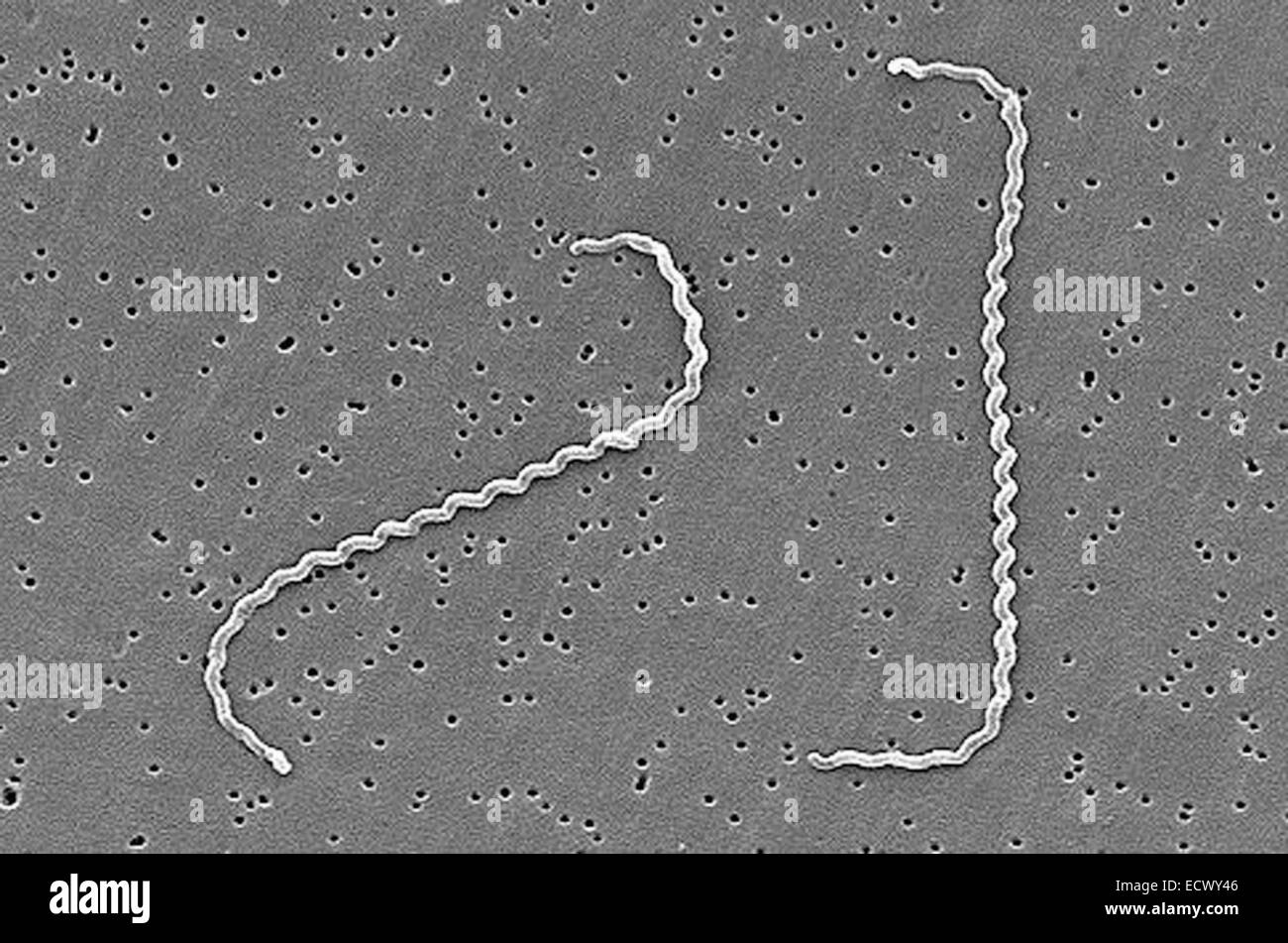 Scanning electron micrograph of Leptospira bacteria. Stock Photo