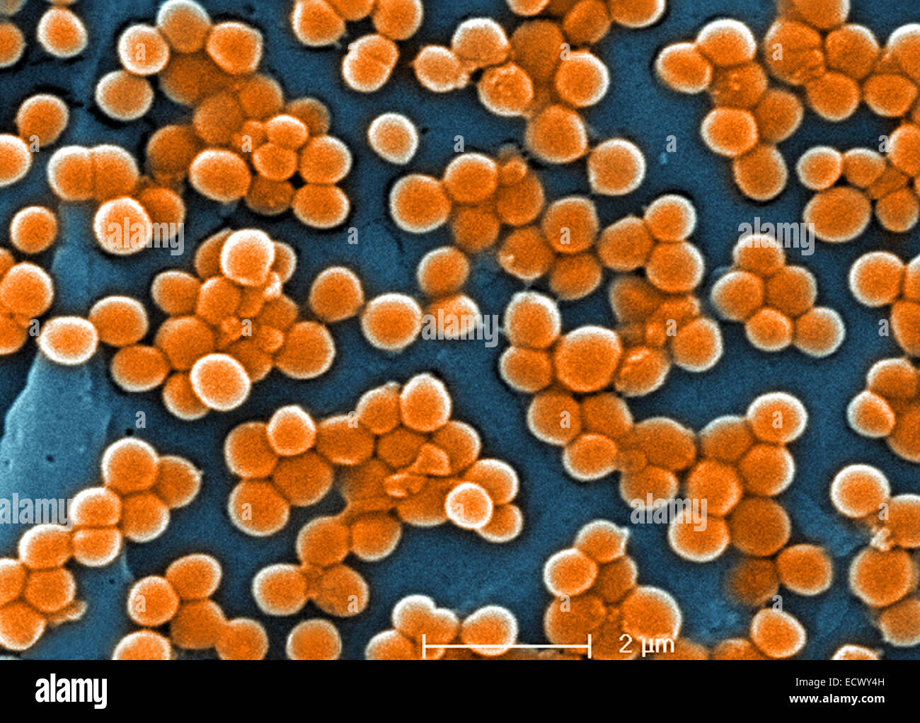 Scanning electron micrograph of MRSA bacteria Stock Photo - Alamy