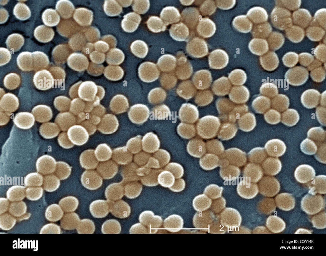 Scanning electron micrograph of MRSA bacteria. Stock Photo