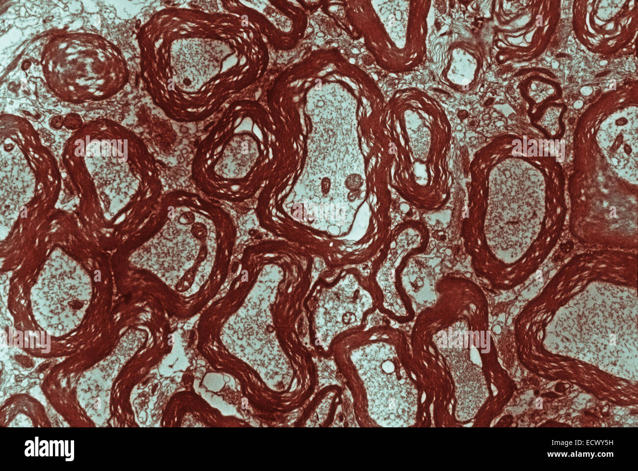 Electron micrograph of canine optic nerve. Stock Photo