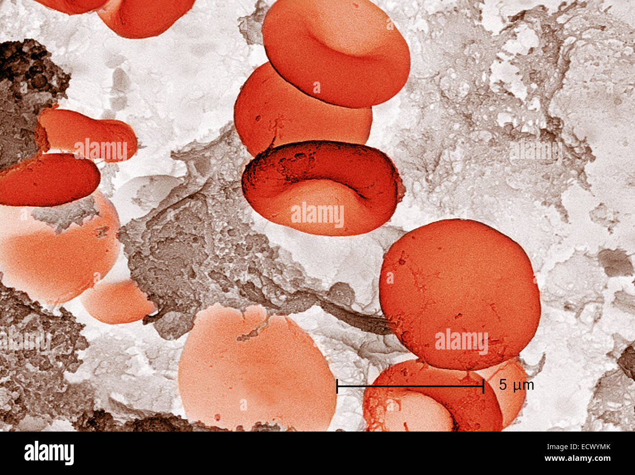 Scanning electron micrograph of red blood cells and fibrin. Stock Photo