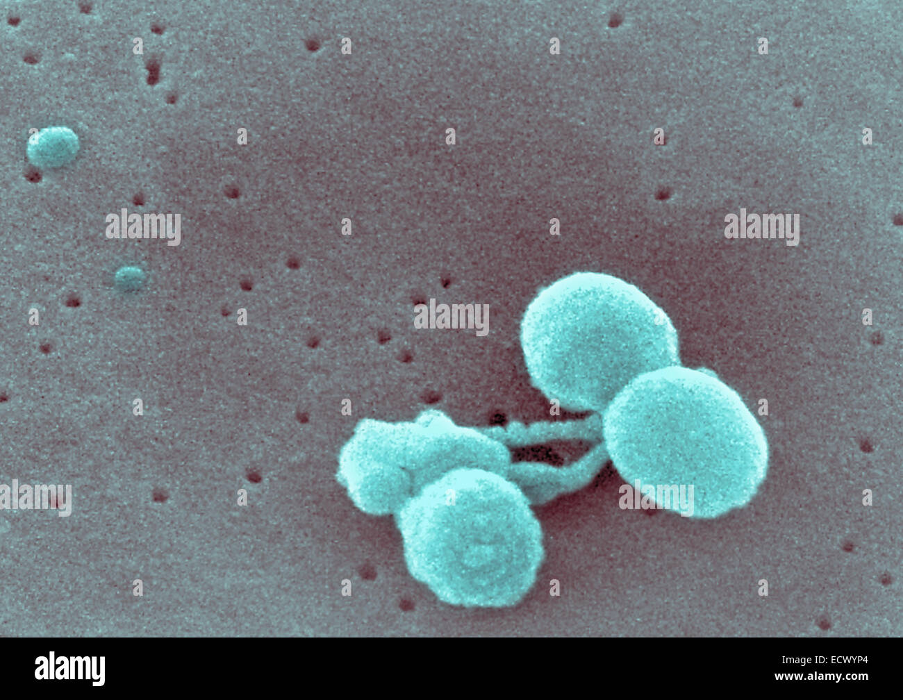 Scanning electron micrograph Streptococcus pneumoniae. Stock Photo