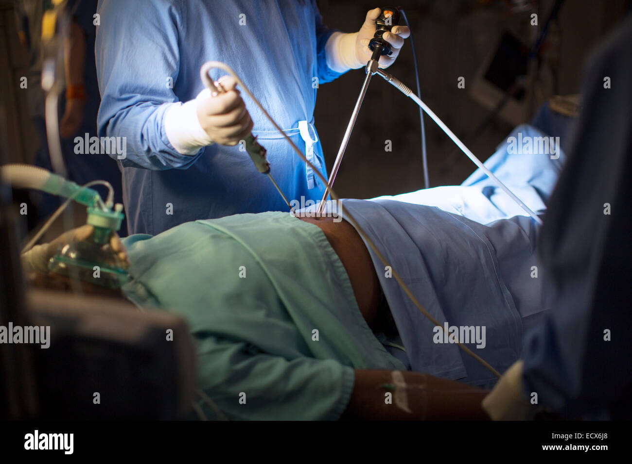 Surgeon holding medical tools and performing laparoscopic surgery in operating theater Stock Photo
