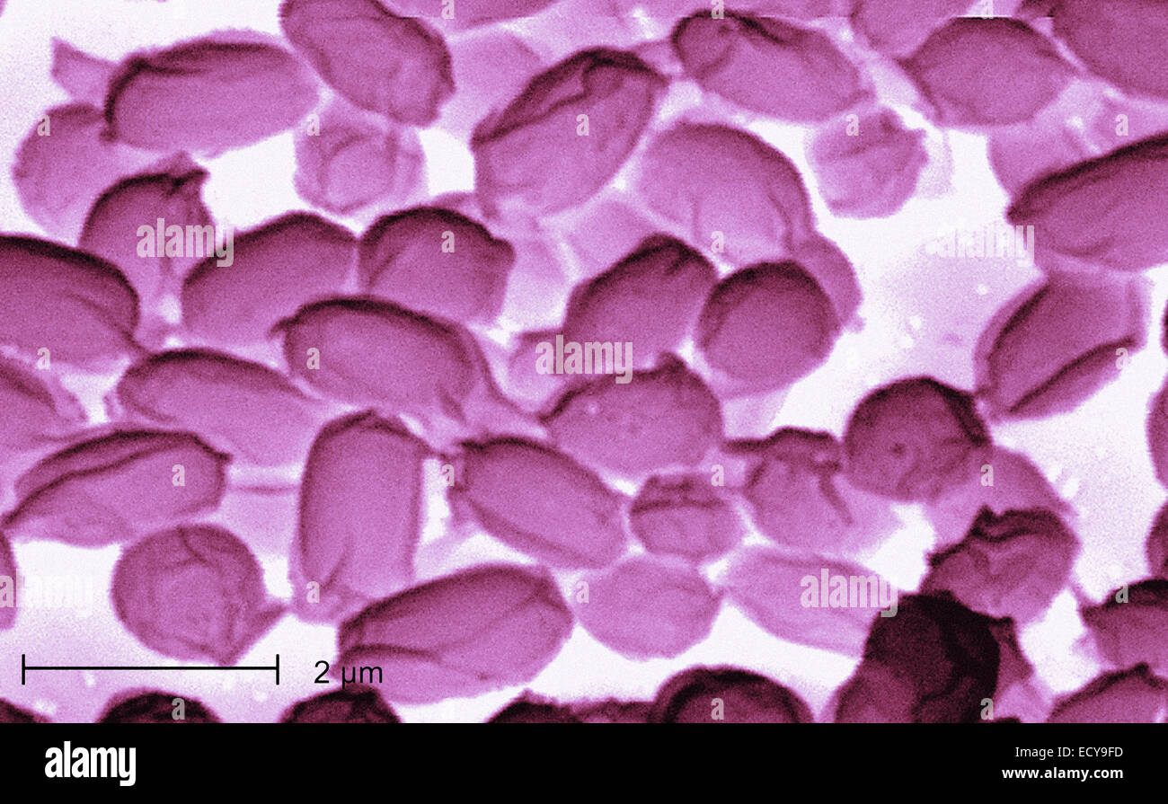 Photomicrograph of Bacillus anthracis (anthrax) spores. Stock Photo