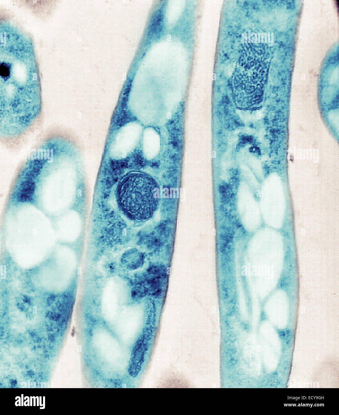 Bacillus anthracis micrograph hires stock photography and images Alamy