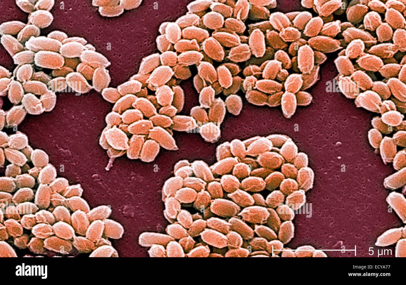 Photomicrograph of Bacillus anthracis (anthrax) spores Stock Photo Alamy