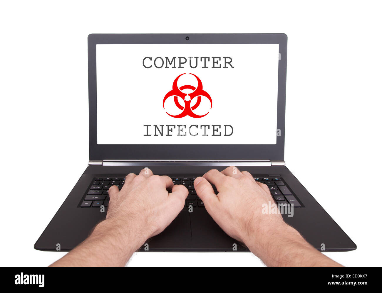 Computer is infected. Your computer is infected. Computer is infected. Computer is infected. Later remover.