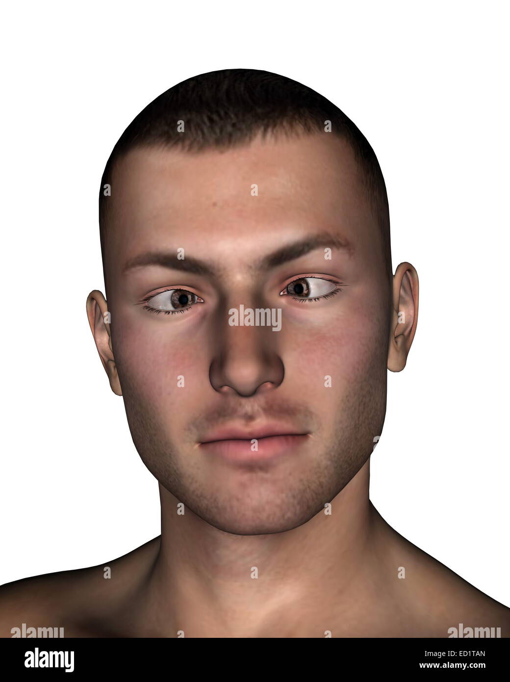 Young man presenting esotropia, eyes turns inward, in white background Stock Photo