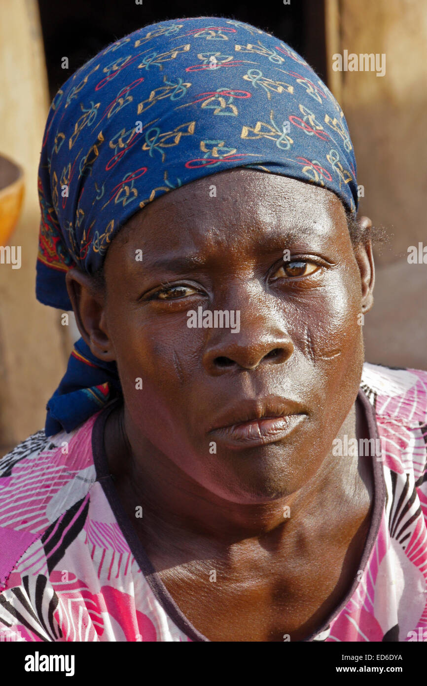 Scarring Stock Photos & Scarring Stock Images - Alamy