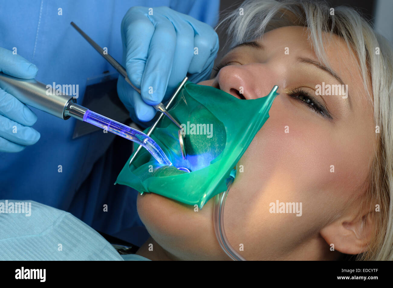 dentist with patient, using dental curing light Stock Photo