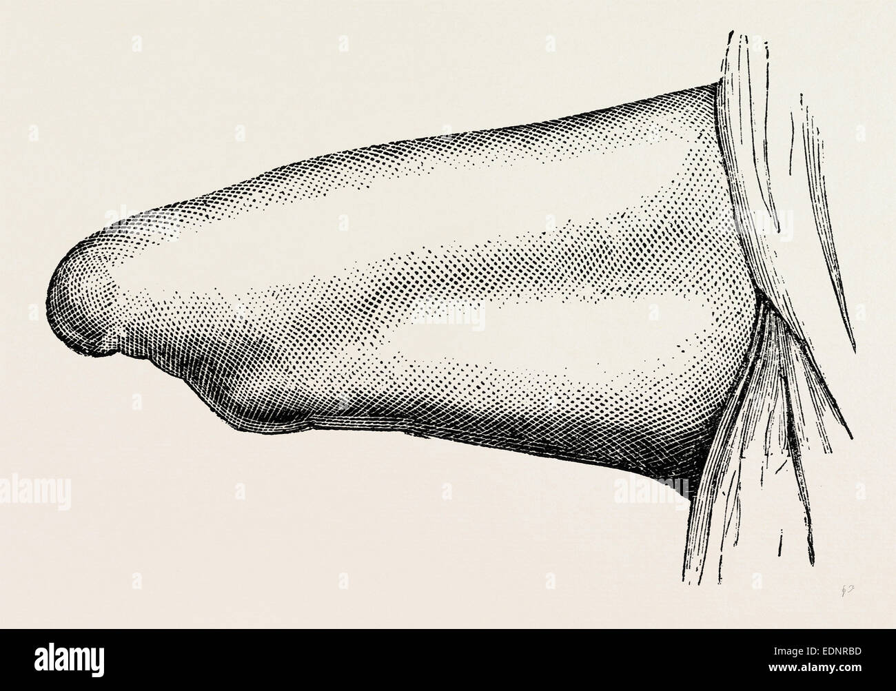 Conical stump hires stock photography and images Alamy