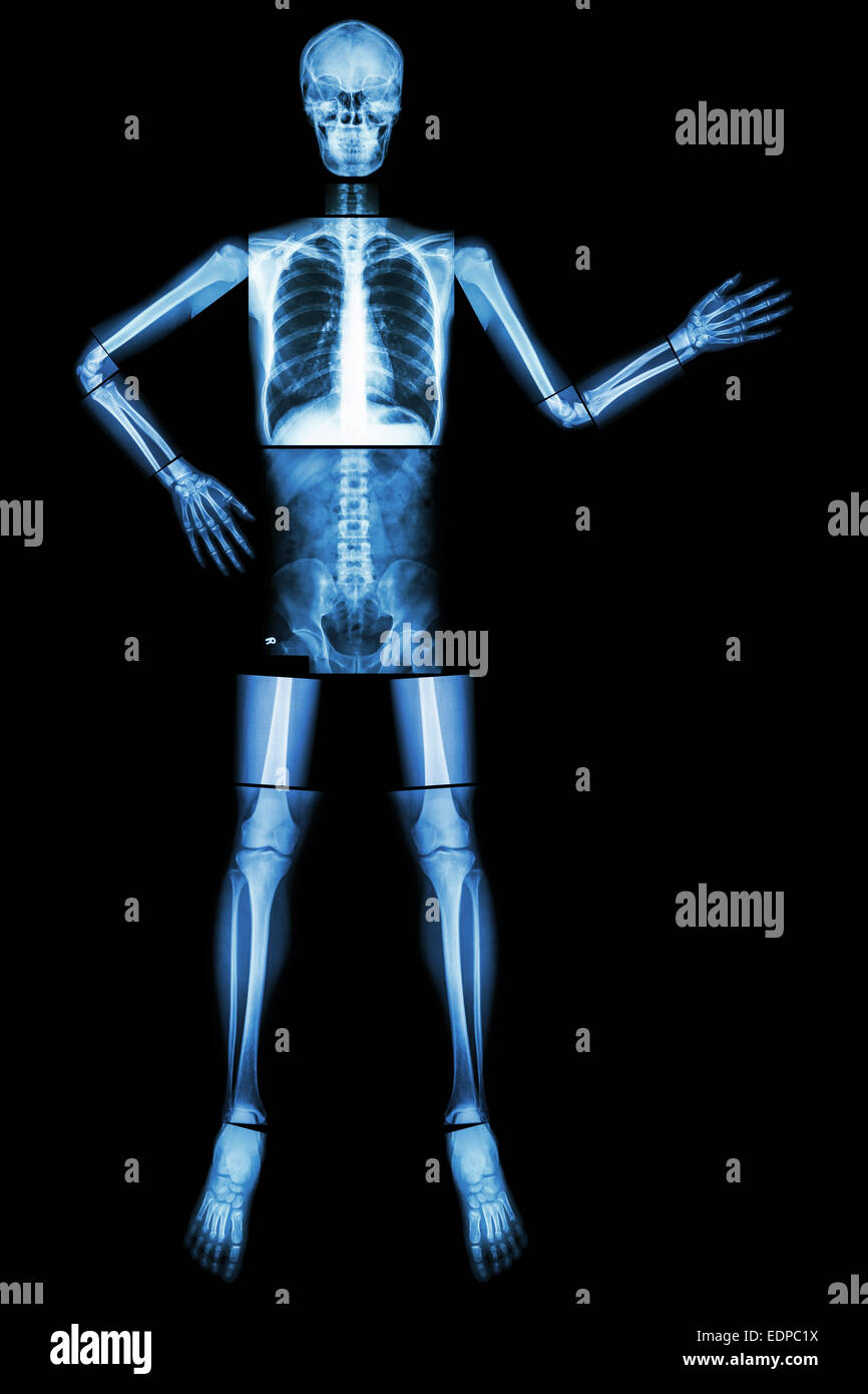 Human skeleton present something (Whole body : head skull neck spine shoulder arm elbow forearm wrist hand finger chest thorax h Stock Photo