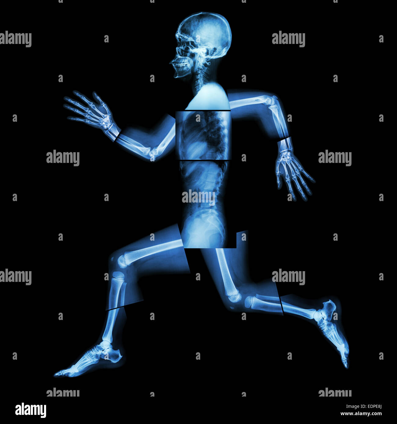 Aerobic Exercise (human bone is running) ,(Whole body x-ray : head ,neck ,shoulder ,shoulder ,arm ,elbow ,forearm ,hand ,finger Stock Photo