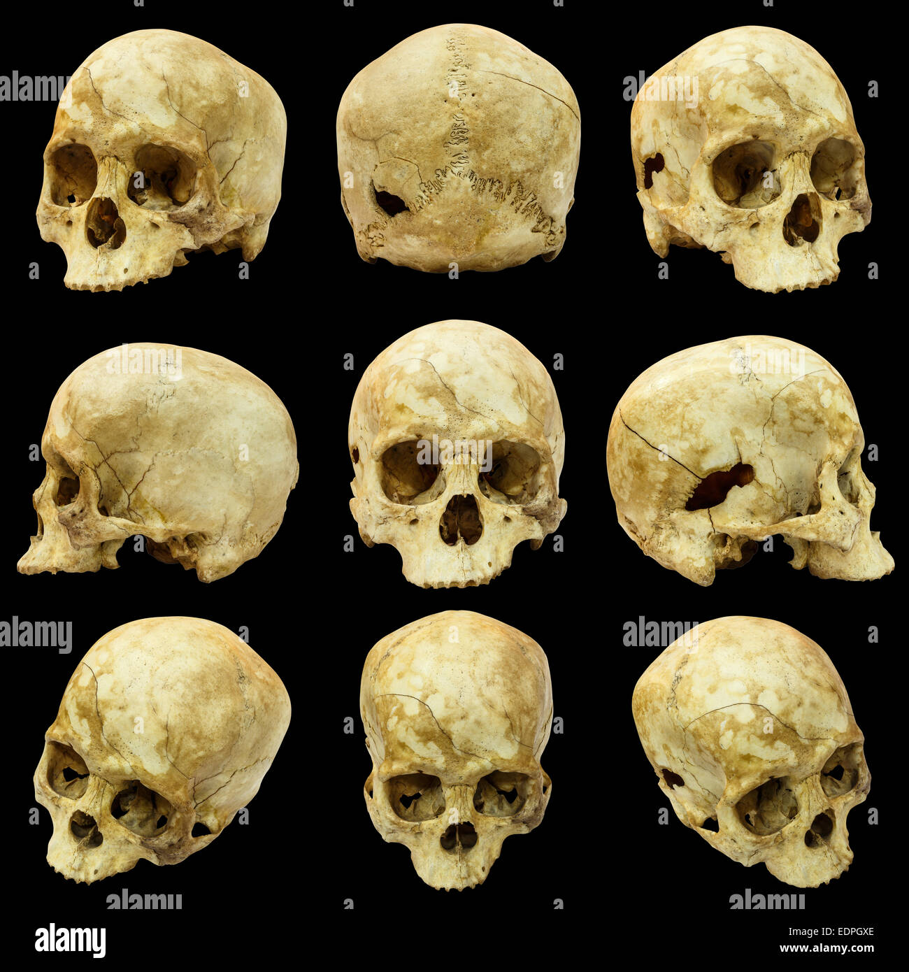 Collection of human skull (Mongoloid) and broken skull Stock Photo
