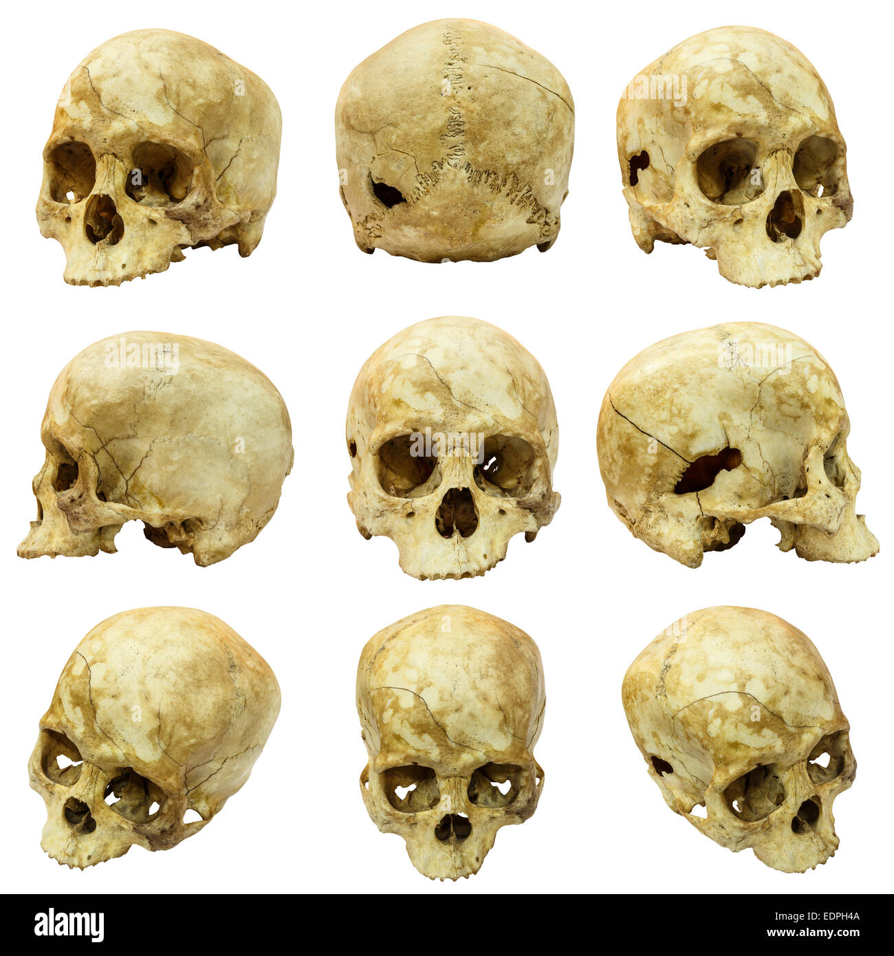 Collection of human skull (Mongoloid) and broken skull Stock Photo