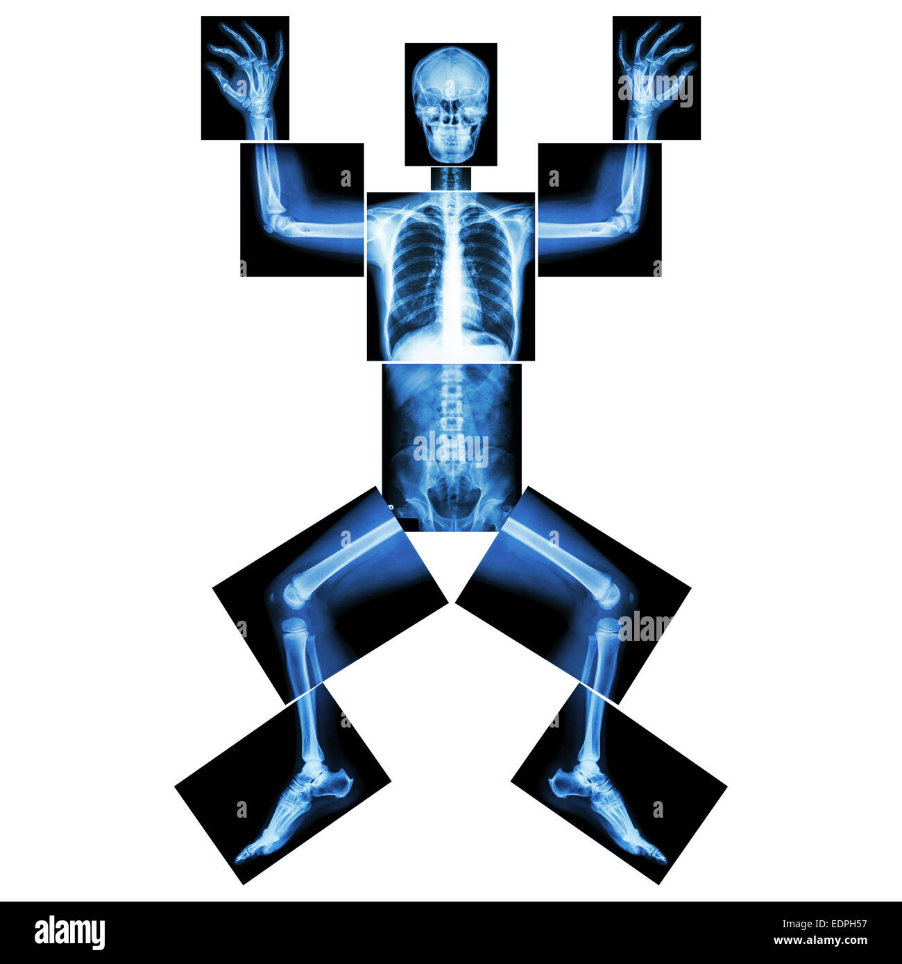 Jigsaw human x-ray ( whole body : head skull face neck spine shoulder arm elbow joint forearm wrist hand finger chest thorax hea Stock Photo