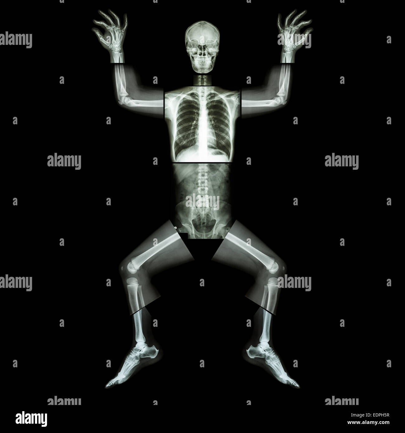 Jigsaw human x-ray ( whole body : head skull face neck spine shoulder arm elbow joint forearm wrist hand finger chest thorax hea Stock Photo
