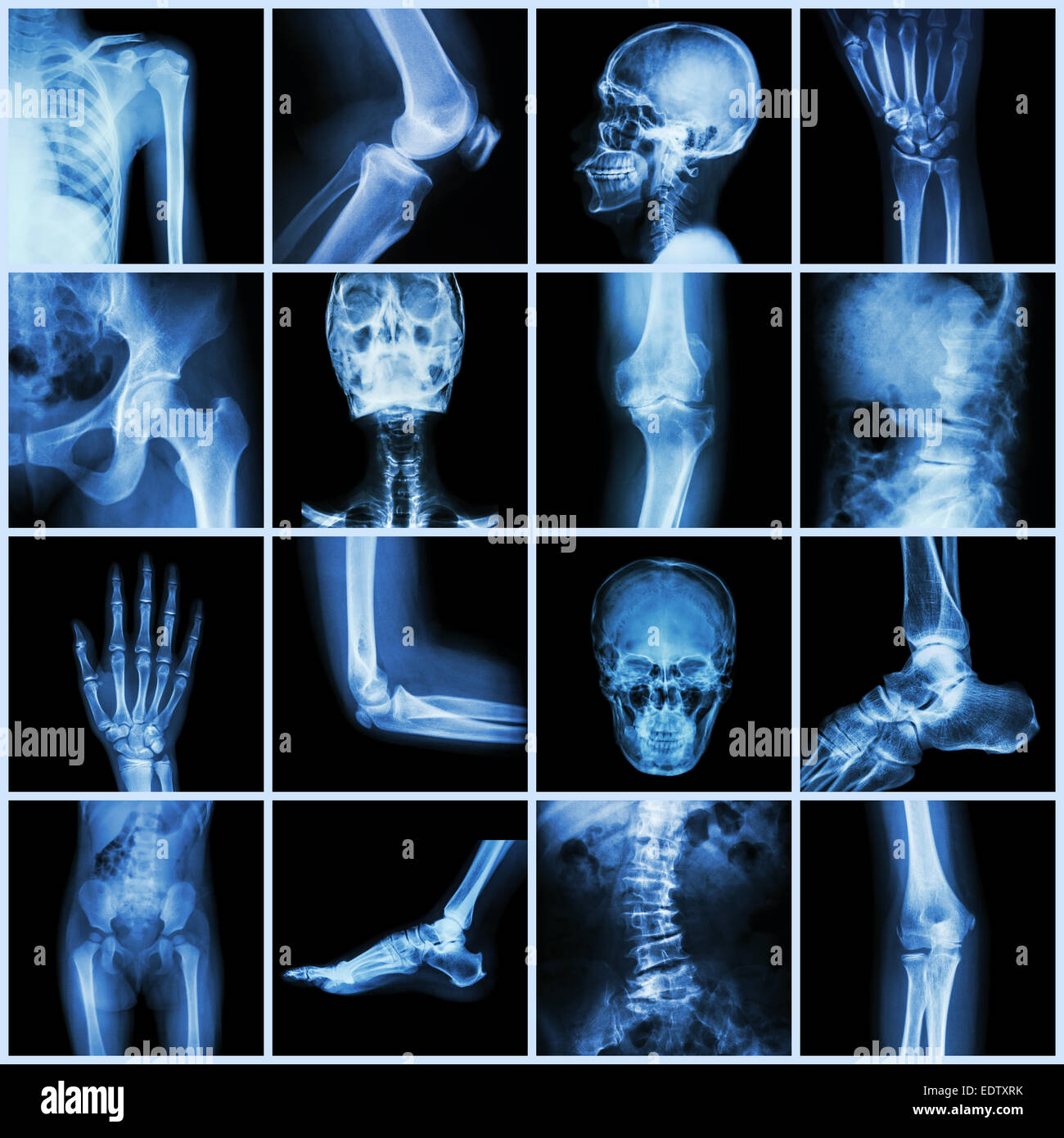 Collection human joint ( skull head neck shoulder chest thorax shoulder arm elbow forearm wrist hand finger palm spine back pelv Stock Photo