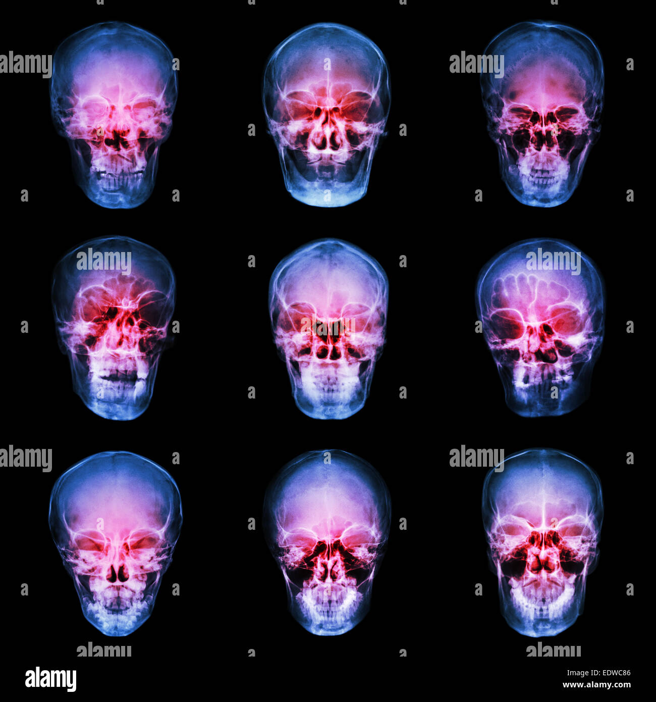 Collection of asian's skull Stock Photo