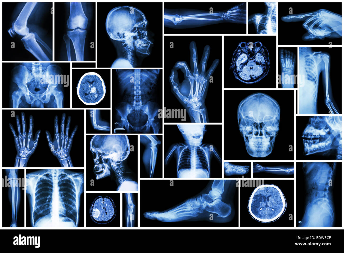 Collection X-ray multiple part of human Stock Photo