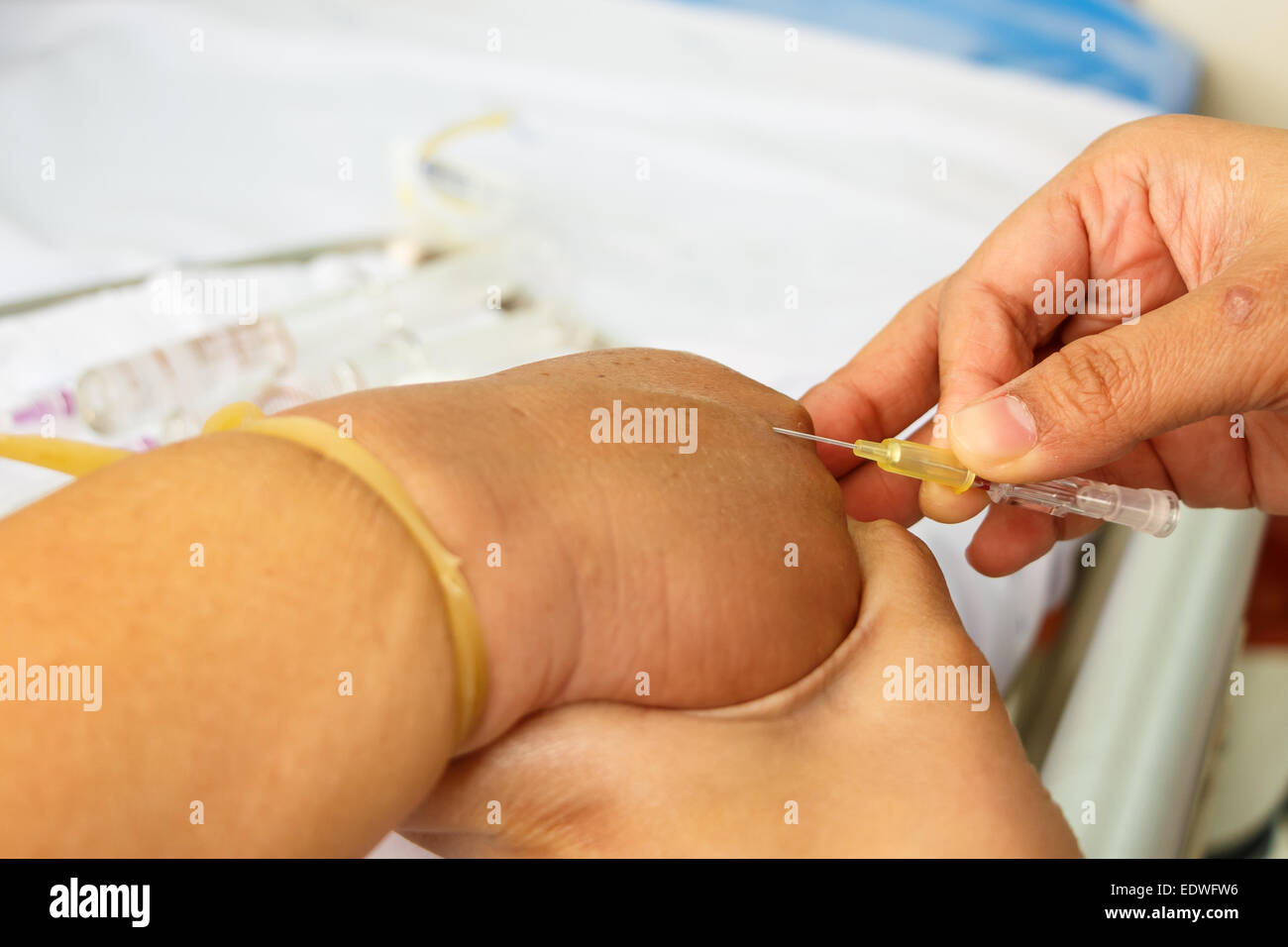 asian nurse inject at patient's hand for intraveneous fluid Stock Photo