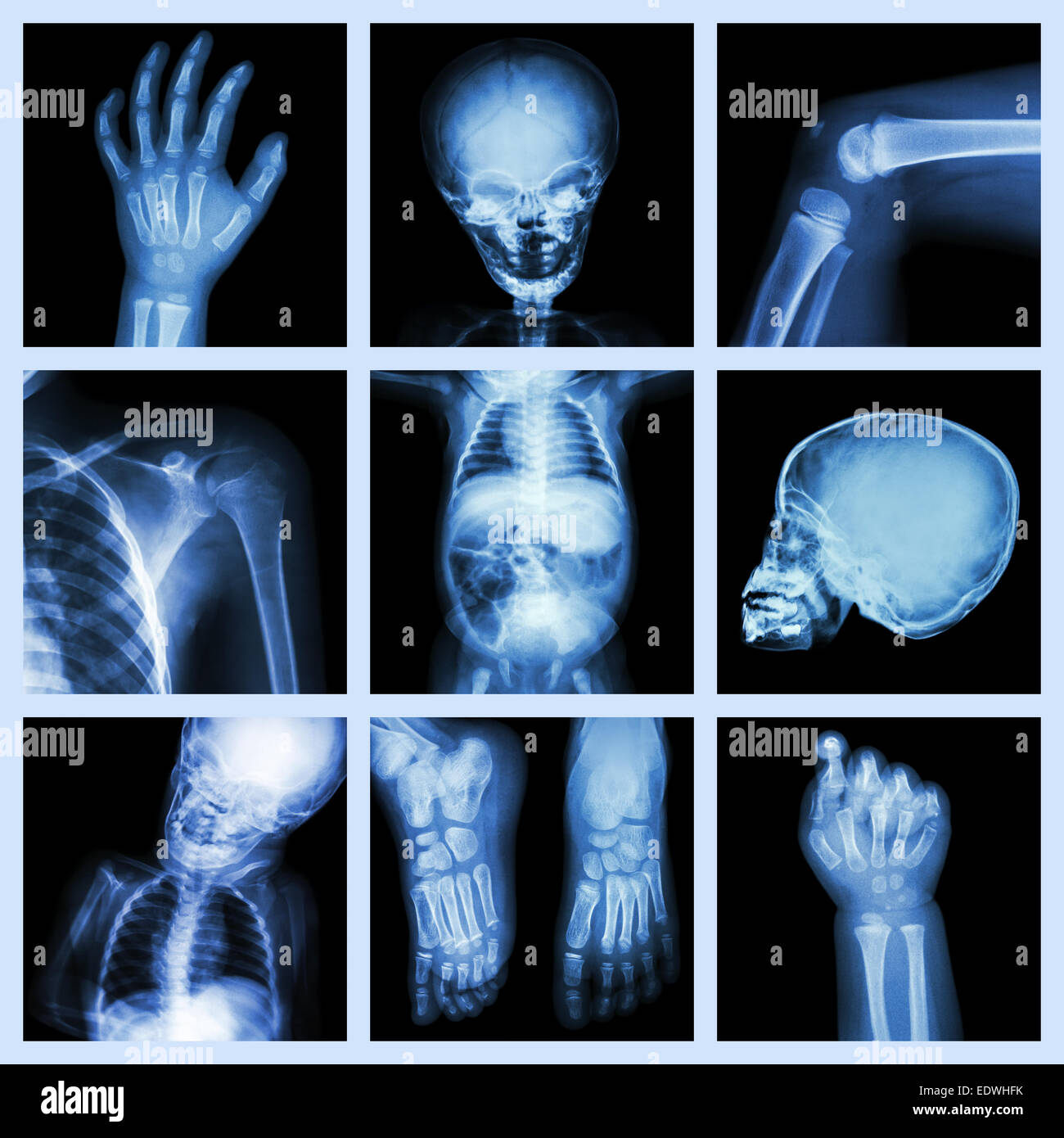 Collection x-ray part of child body Stock Photo
