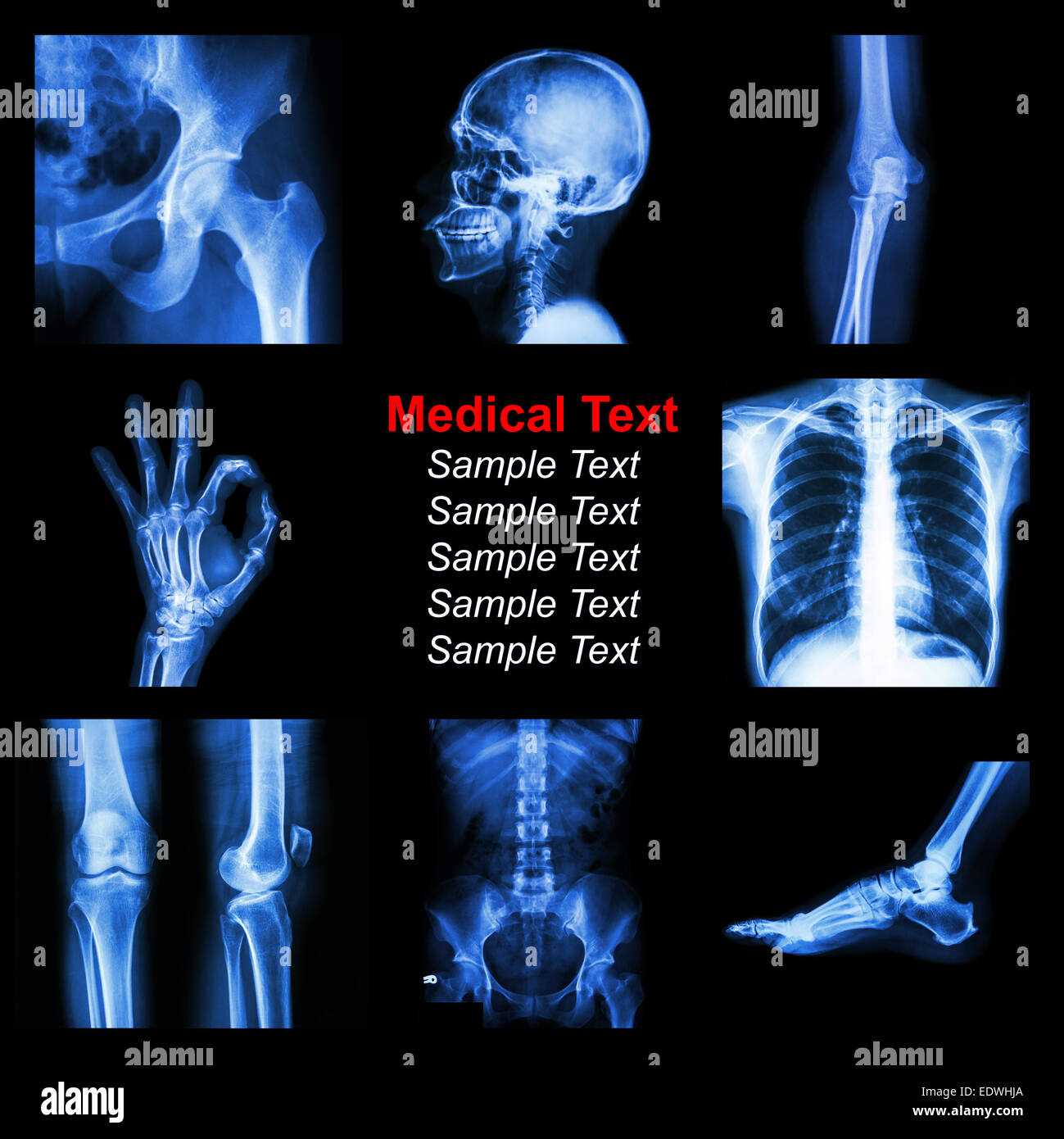 Collection of X-ray part of human Stock Photo