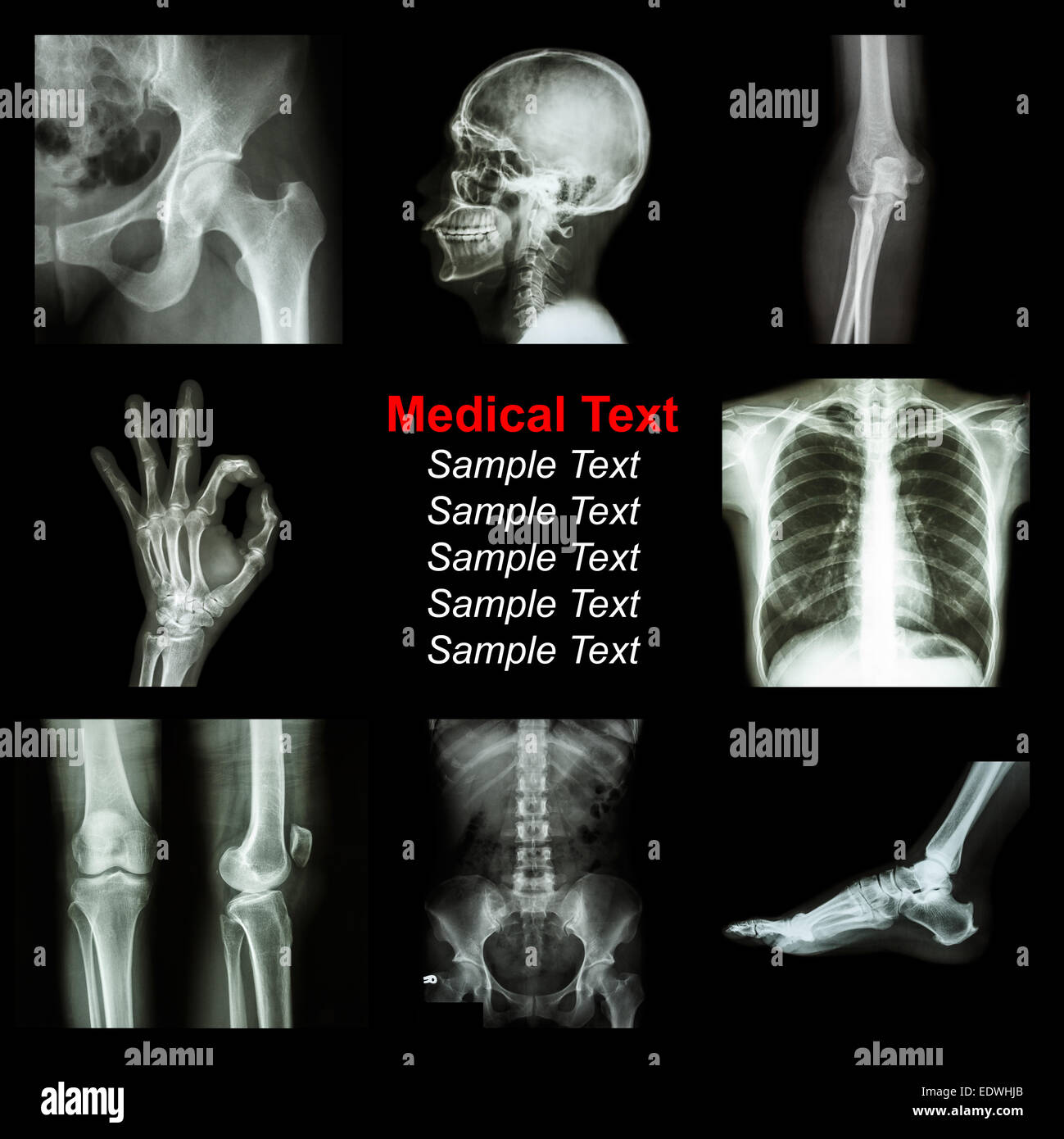 Collection of X-ray part of human Stock Photo