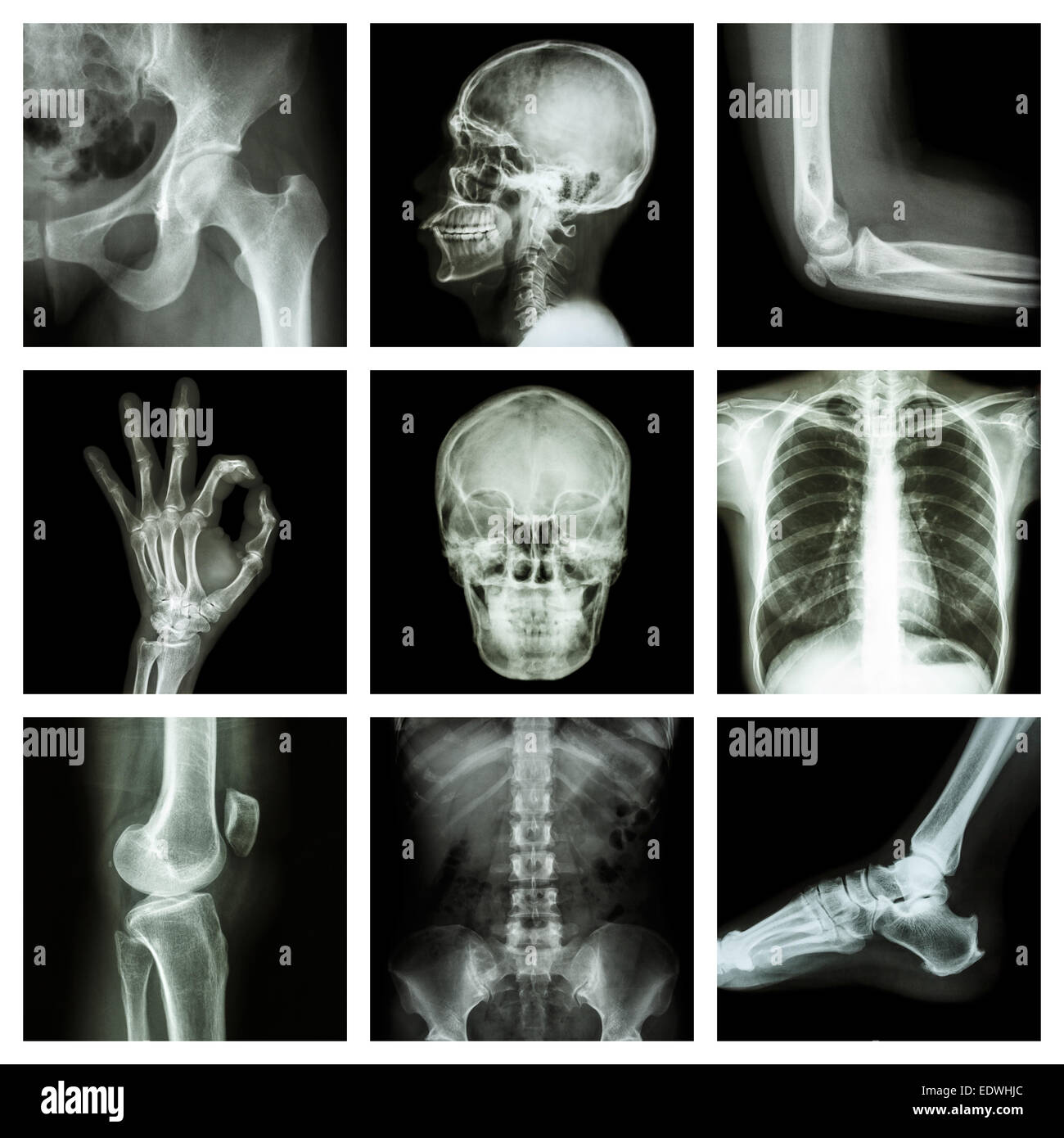 Collection X-ray part of human Stock Photo